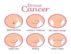 how to detect breast cancer and why early detection is important.